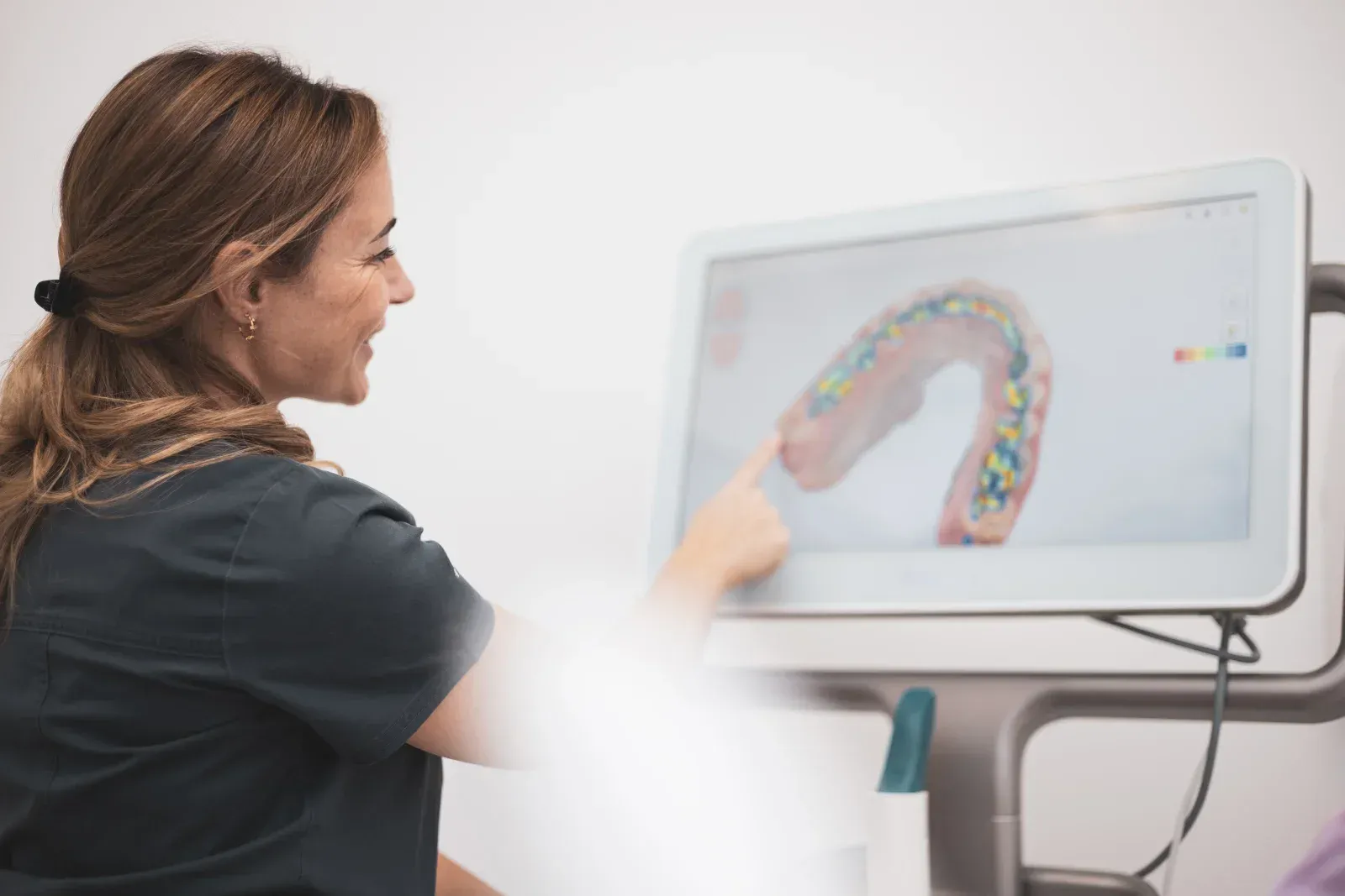 3D Scan in Orthodontics: Your Smile Planned Digitally