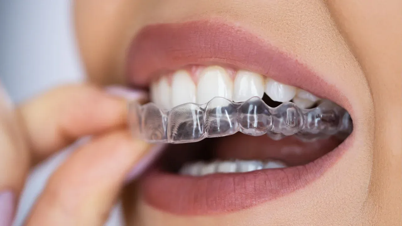 Aligner Mythen bei Hakim Healthcare Frankfurt