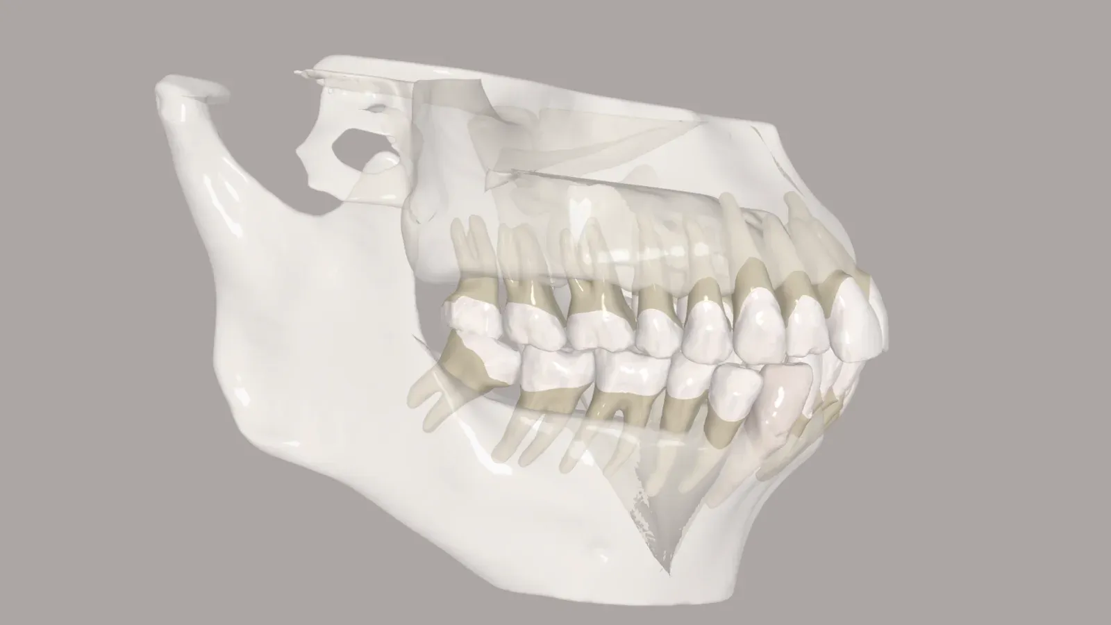 DVT in der Kieferorthopädie Frankfurt | Präzise 3D-Diagnostik & Planung
